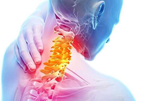 Die Ursachen für zervikale Osteochondrose