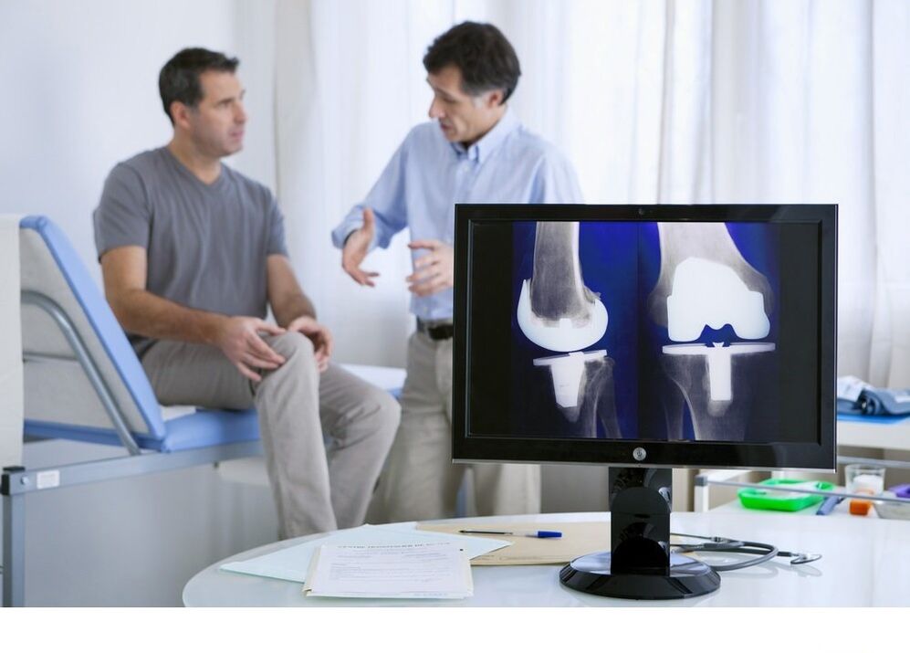 Kniegelenks -Osteoarthritis in Bild x -Strahl